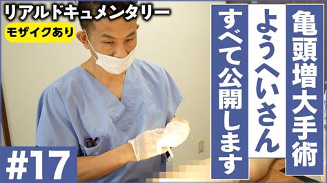 亀頭増大 銀座|包茎手術・包茎治療は認定専門医の元で！ [東京・大。